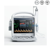 Tragbarer diagnostischer Doppler-Digitalfarbultraschall